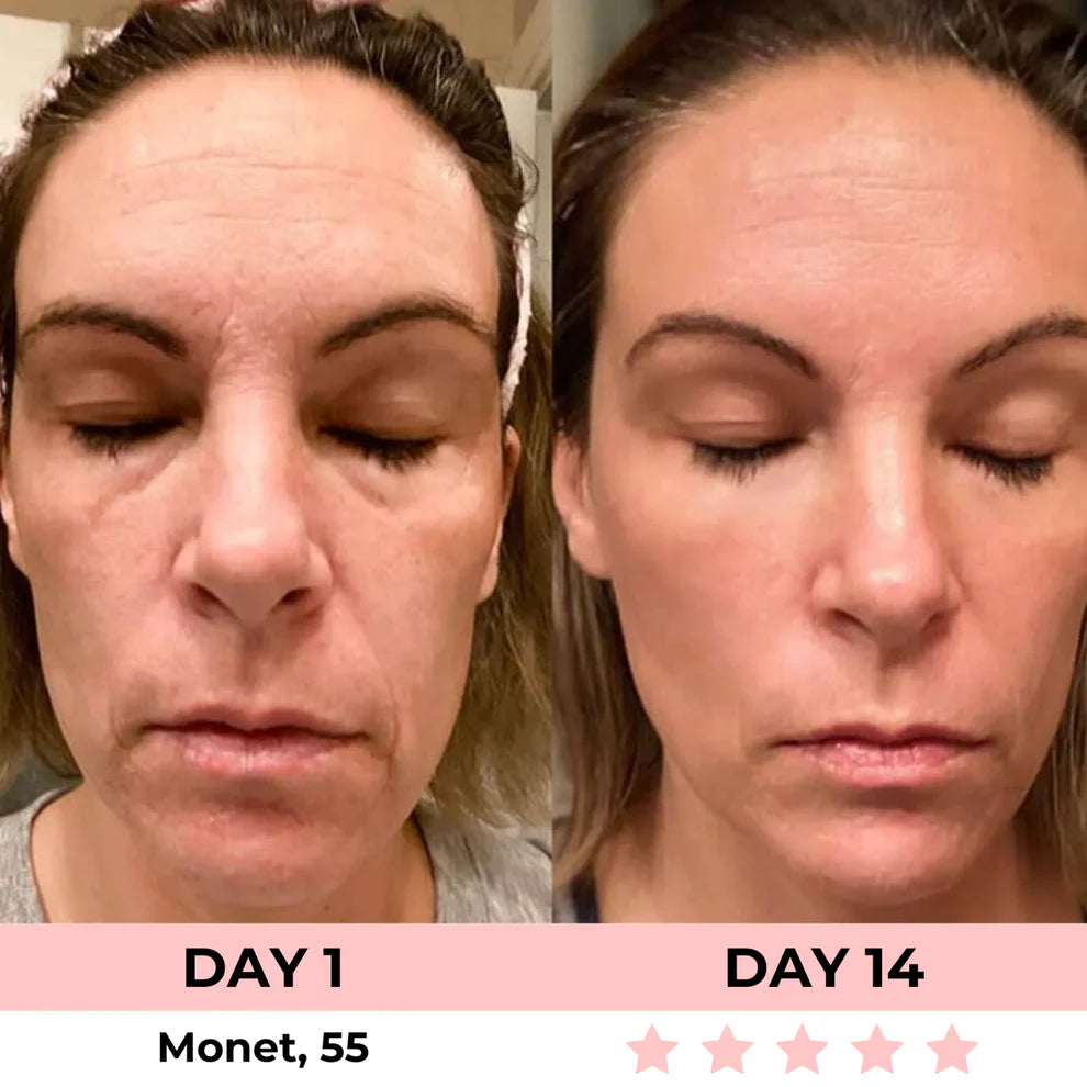 Celestiqa 7-in-1 LED Facial Sculptor