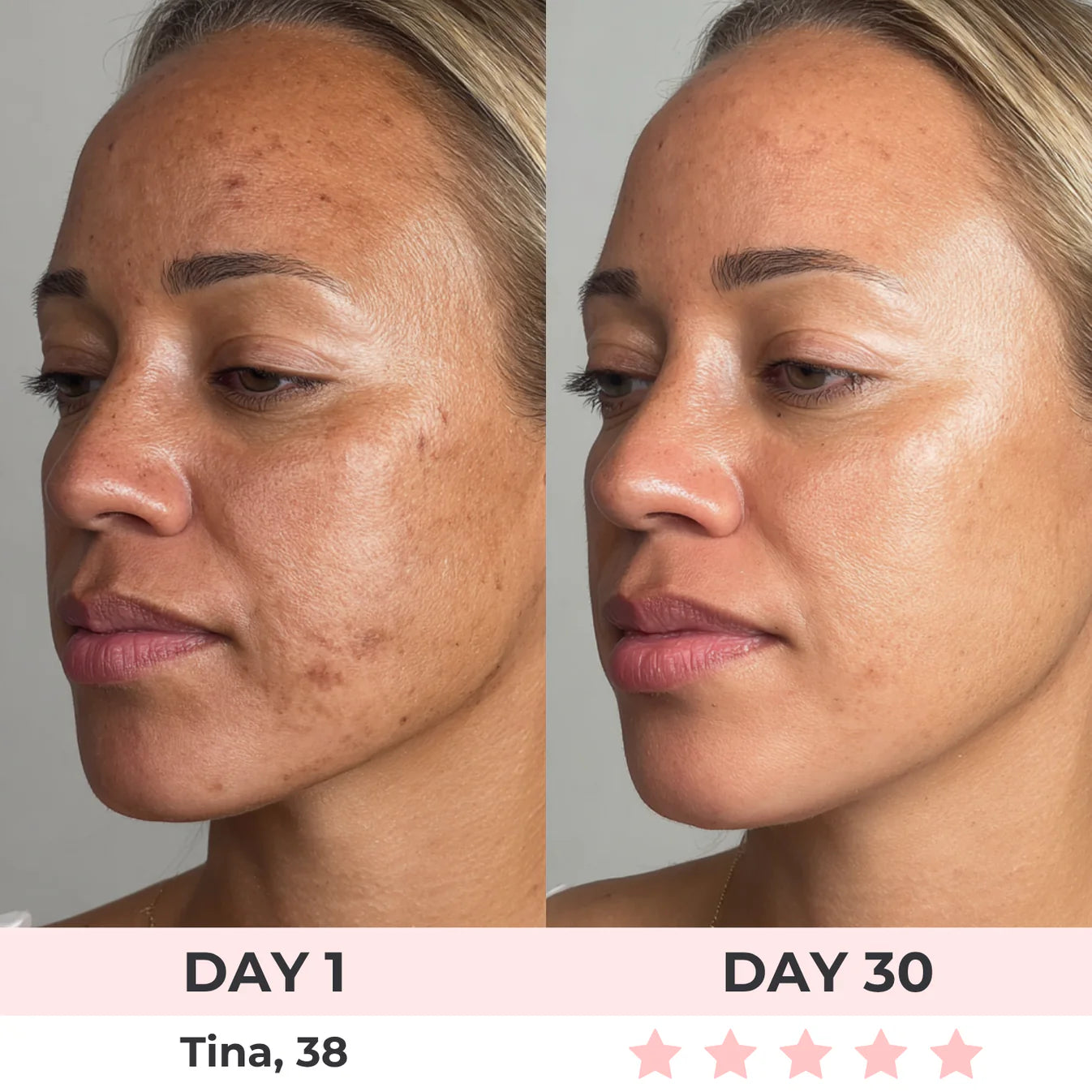 Celestiqa 7-in-1 LED Facial Sculptor