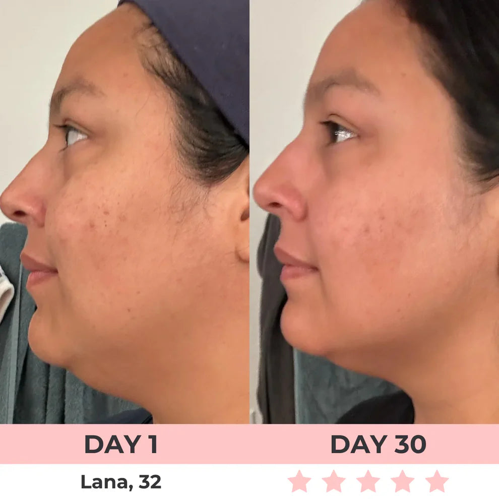 Celestiqa 7-in-1 LED Facial Sculptor